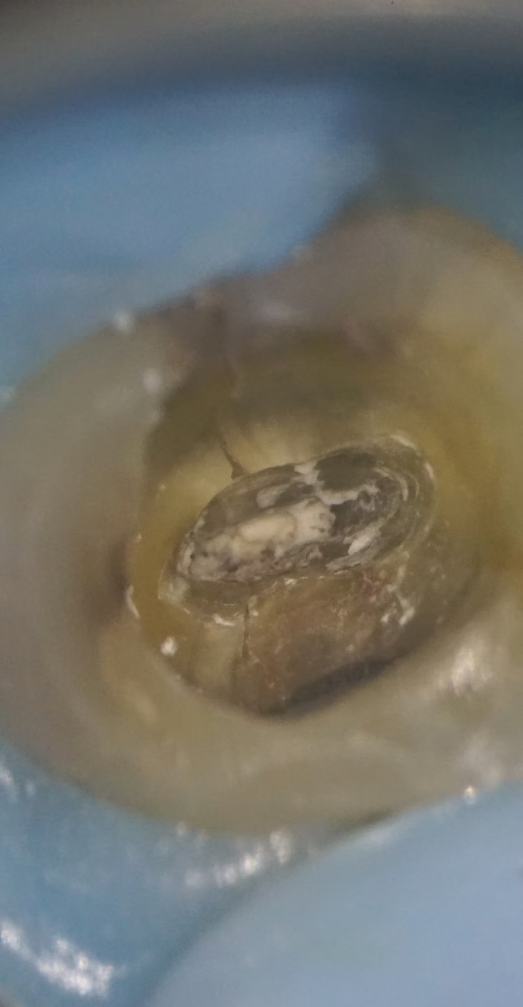 Klinisk mikroskopfoto af en tand med en synlig revne